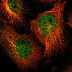 ZNF44 Antibody, Novus Biologicals 0.1mL; Unlabeled:Antibodies, Polyclonal